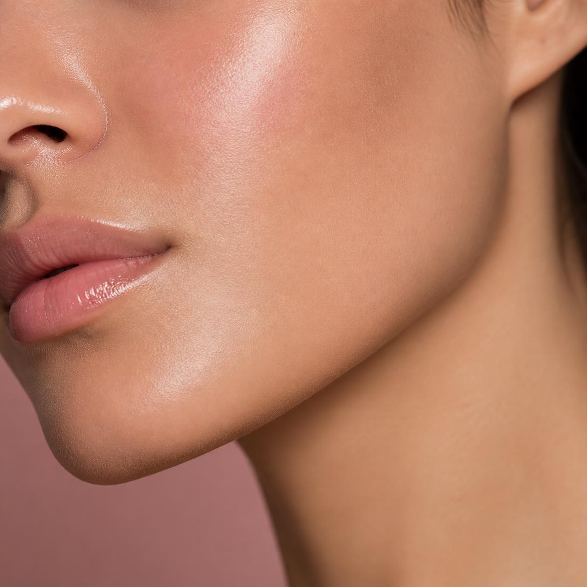 Exion RF Microneedling